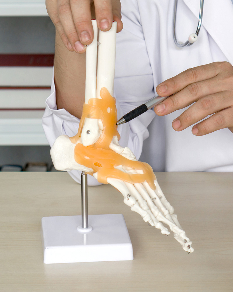 Ankle Ligament Surgery Your Recovery